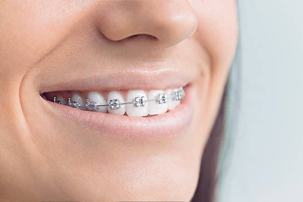 Best Veneers and Lumineers  in Albion, NE